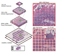 记录--病理切片图像处理