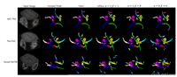 MICCAI 2024Centerline Boundary Dice Loss for Vascular Segmentation
